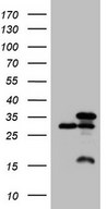 HEK293T cells were transfected with the pCMV6-ENTRY control (Left lane) or pCMV6-ENTRY SNRPB2 (Right lane) cDNA for 48 hrs and lysed. Equivalent amounts of cell lysates (5 ug per lane) were separated by SDS-PAGE and immunoblotted with anti-SNRPB2 (1:2000).