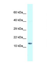 SNRPD1 antibody LS-C145692 Western blot of Mouse Liver lysate. Antibody concentration 1 ug/ml.