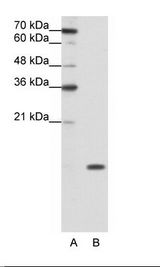 A: Marker, B: Jurkat Cell Lysate