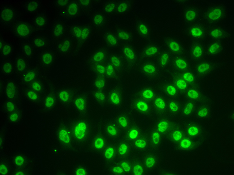 Immunofluorescence blot of MCF7 cell using SNRPD1 antibody.