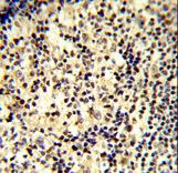 Formalin-fixed and paraffin-embedded human tonsil tissue reacted with SNRPD1 Antibody , which was peroxidase-conjugated to the secondary antibody, followed by DAB staining. This data demonstrates the use of this antibody for immunohistochemistry; clinical relevance has not been evaluated.
