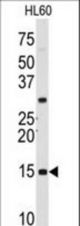 Western blot of anti-SNRPD1 Antibody in HL60 cell line lysates (35 ug/lane). SNRPD1 (arrow) was detected using the purified antibody.