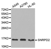 Western blot analysis of extracts of Mouse pancreas cell lines, using SNRPD2 antibody.