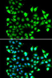 Immunofluorescence blot of MCF7 cell using SNRPD2 antibody. Blue: DAPI for nuclear staining.