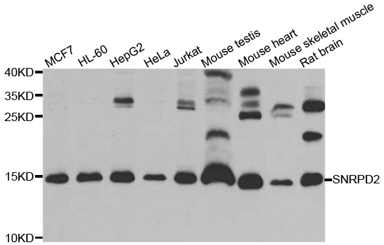Western blot blot of extracts of various cell lines, using SNRPD2 antibody.