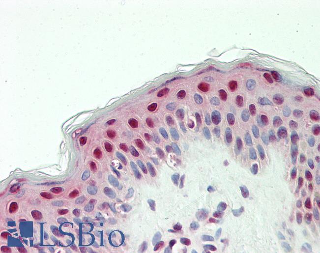 Anti-SNRPD2 antibody IHC staining of human skin. Immunohistochemistry of formalin-fixed, paraffin-embedded tissue after heat-induced antigen retrieval. Antibody LS-B11357 concentration 20 ug/ml.