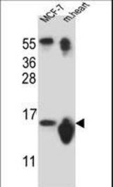 SNRPD3 Antibody western blot of MCF-7 cell line and mouse heart tissue lysates (35 ug/lane). The SNRPD3 antibody detected the SNRPD3 protein (arrow).