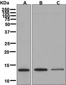 Western blot analysis on (A) Jurkat, (B) 293T, and (C) Caco-2 cell lysates using anti-SNRPD3 antibody.