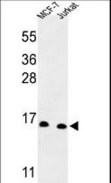 Western blot of SNRPD3 Antibody in MCF-7, Jurkat cell line lysates (35 ug/lane). SNRPD3 (arrow) was detected using the purified antibody.