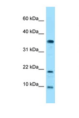 SNRPE antibody LS-C146244 Western blot of HeLa Cell lysate. Antibody concentration 1 ug/ml.