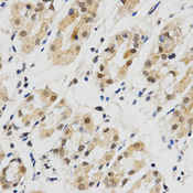 Immunohistochemistry of paraffin-embedded human stomach using SNRPE antibody at dilution of 1:200 (x400 lens)