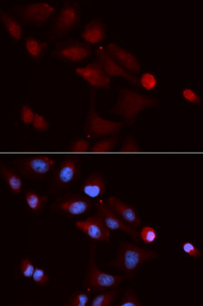 Immunofluorescence analysis of U20S cell using SNRPE antibody. Blue: DAPI for nuclear staining.