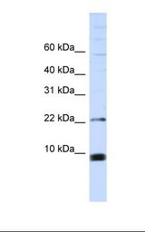 MCF7 cell lysate. Antibody concentration: 1.0 ug/ml. Gel concentration: 10-20%.