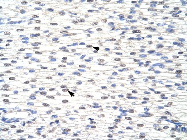 SNRPF antibody LS-C30552 was used in IHC to stain formalin-fixed, paraffin-embedded human heart.