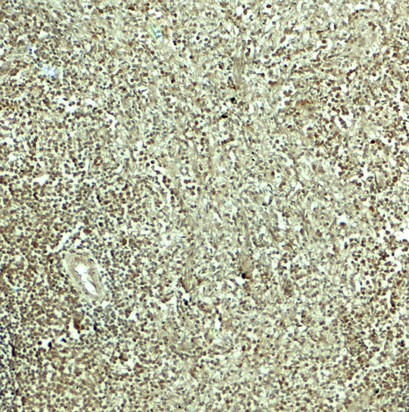 Immunohistochemistry of SNRPN in human spleen tissue with SNRPN antibody at 5 ug/mL.