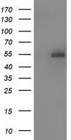 HEK293T cells were transfected with the pCMV6-ENTRY control (Left lane) or pCMV6-ENTRY SNTA1 (Right lane) cDNA for 48 hrs and lysed. Equivalent amounts of cell lysates (5 ug per lane) were separated by SDS-PAGE and immunoblotted with anti-SNTA1.