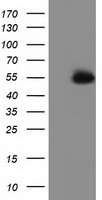 HEK293T cells were transfected with the pCMV6-ENTRY control (Left lane) or pCMV6-ENTRY SNTA1 (Right lane) cDNA for 48 hrs and lysed. Equivalent amounts of cell lysates (5 ug per lane) were separated by SDS-PAGE and immunoblotted with anti-SNTA1.