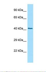 Western blot of Human 293T. SNTA1 antibody dilution 1.0 ug/ml.