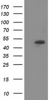 HEK293T cells were transfected with the pCMV6-ENTRY control (Left lane) or pCMV6-ENTRY SNTA1 (Right lane) cDNA for 48 hrs and lysed. Equivalent amounts of cell lysates (5 ug per lane) were separated by SDS-PAGE and immunoblotted with anti-SNTA1.