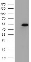 HEK293T cells were transfected with the pCMV6-ENTRY control (Left lane) or pCMV6-ENTRY SNTA1 (Right lane) cDNA for 48 hrs and lysed. Equivalent amounts of cell lysates (5 ug per lane) were separated by SDS-PAGE and immunoblotted with anti-SNTA1.