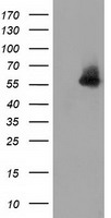 HEK293T cells were transfected with the pCMV6-ENTRY control (Left lane) or pCMV6-ENTRY SNTA1 (Right lane) cDNA for 48 hrs and lysed. Equivalent amounts of cell lysates (5 ug per lane) were separated by SDS-PAGE and immunoblotted with anti-SNTA1.
