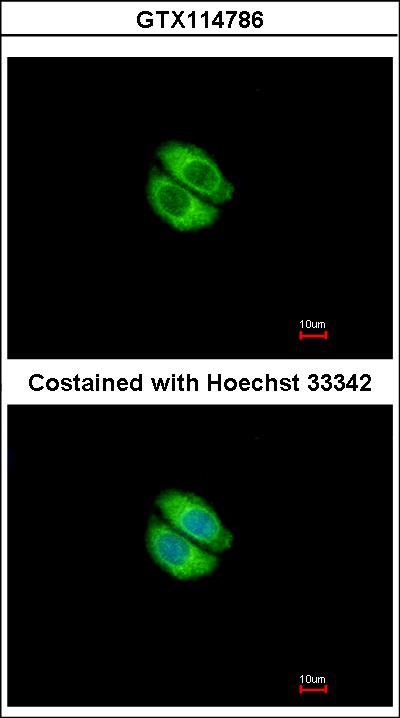 Immunofluorescence of methanol-fixed A549 using Syntrophin alpha 1 antibody at 1:500 dilution.