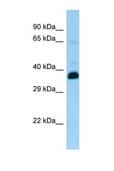 SNUPN antibody LS-C146403 Western blot of Rat Brain lysate. Antibody concentration 1 ug/ml.