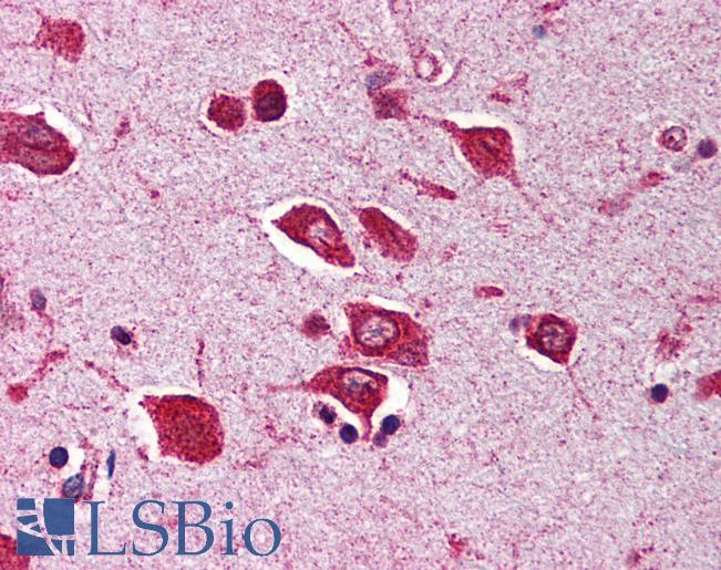 Anti-SNW1 antibody IHC of human brain, cortex. Immunohistochemistry of formalin-fixed, paraffin-embedded tissue after heat-induced antigen retrieval. Antibody LS-B590 concentration 5 ug/ml.
