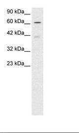 Jurkat Cell Lysate