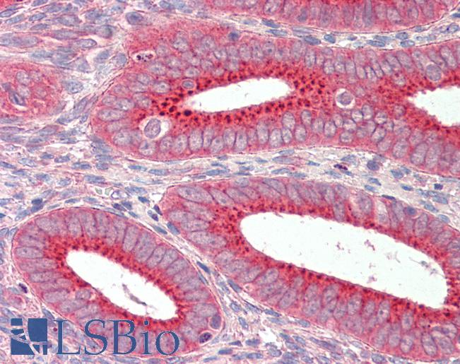 Anti-SNX1 antibody IHC staining of human uterus. Immunohistochemistry of formalin-fixed, paraffin-embedded tissue after heat-induced antigen retrieval.