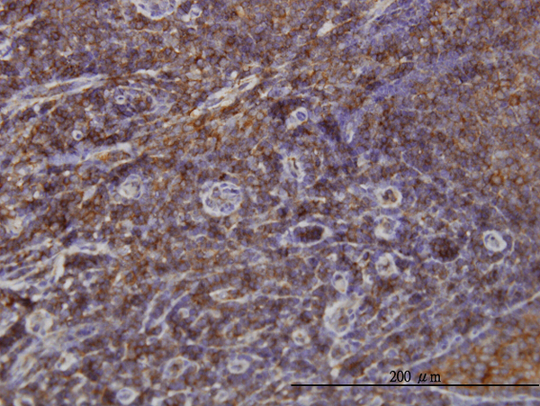 Immunoperoxidase of monoclonal antibody to SNX1 on formalin-fixed paraffin-embedded human tonsil. [antibody concentration 3 ug/ml]