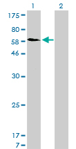 Western blot of SNX1 expression in transfected 293T cell line by SNX1 monoclonal antibody (M01), clone 6H1.