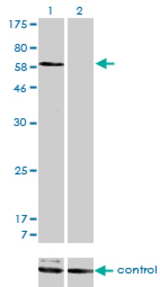 Western blot of SNX1 over-expressed 293 cell line, cotransfected with SNX1 Validated Chimera RNAi (Lane 2) or non-transfected control (Lane 1). Blot probed with SNX1 monoclonal antibody, clone 6H1. GAPDH ( 36.1 kD ) used as specificity an.