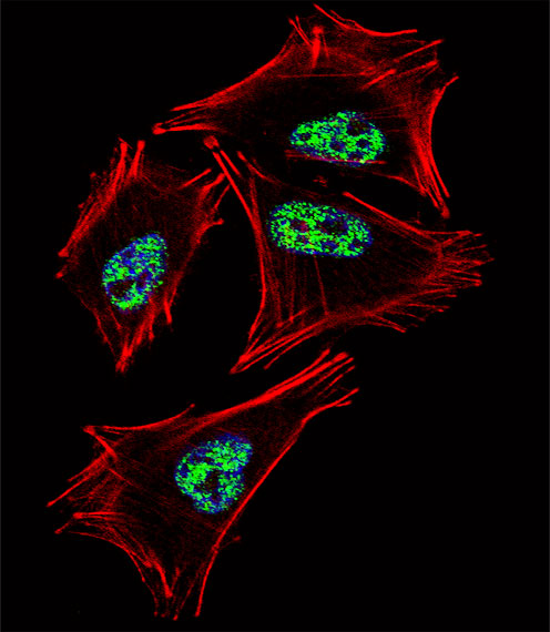 Fluorescent confocal image of A2058 cell stained with PROX1 Antibody. A2058 cells were fixed with 4% PFA (20 min), permeabilized with Triton X-100 (0.1%, 10 min), then incubated with PROX1 primary antibody (1:25, 1 h at 37°C). For secondary antibody, Alexa Fluor 488 conjugated donkey anti-rabbit antibody (green) was used (1:400, 50 min at 37°C). Cytoplasmic actin was counterstained with Alexa Fluor 555 (red) conjugated Phalloidin (7units/ml, 1 h at 37°C). Nuclei were counterstained with DAPI (blue) (10 ug/ml, 10 min). PROX1 immunoreactivity is localized to Nucleus significantly.