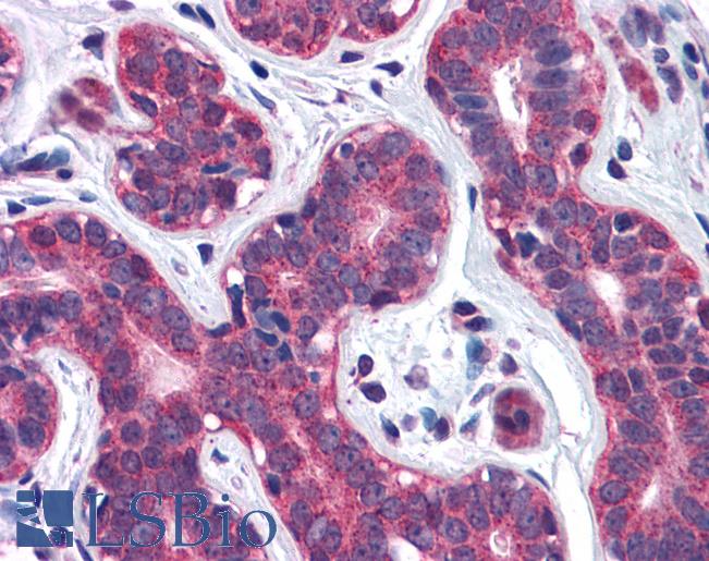 Anti-SNX12 antibody IHC of human breast. Immunohistochemistry of formalin-fixed, paraffin-embedded tissue after heat-induced antigen retrieval. Antibody LS-B4964 concentration 3.75 ug/ml.