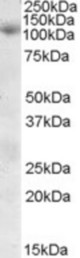 Antibody (0.3 ug/ml) staining of Human Skeletal Muscle lysate (35 ug protein in RIPA buffer). Primary incubation was 1 hour. Detected by chemiluminescence