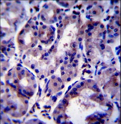 SNX24 Antibody immunohistochemistry of formalin-fixed and paraffin-embedded human stomach tissue followed by peroxidase-conjugated secondary antibody and DAB staining.
