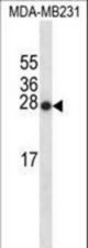 SNX24 Antibody western blot of MDA-MB231 cell line lysates (35 ug/lane). The SNX24 antibody detected the SNX24 protein (arrow).