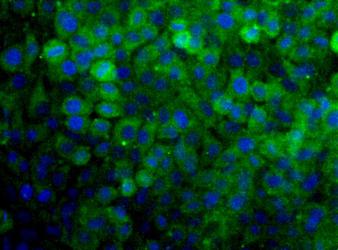 SNX27 Antibody - Detection of SNX27 (Green) in Hela cells. Nuclei (Blue) are counterstained using Hoechst 33258.