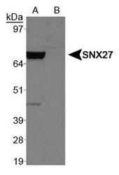 SNX27 Antibody - Western blot of SNX27 antibody in A. 293T + tagged SNX27 protein and B. 293T empty vector.