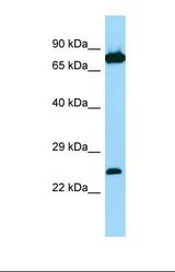 Western blot of Human Jurkat. SNX27 antibody dilution 1.0 ug/ml.