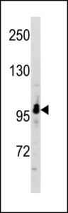 RUNDC2A Antibody western blot of A549 cell line lysates (35 ug/lane). The RUNDC2A antibody detected the RUNDC2A protein (arrow).
