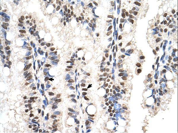 RUNDC2A antibody LS-C81111 was used in IHC to stain formalin-fixed, paraffin-embedded human intestine.