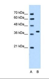 Lane A: Marker. Lane B: HepG2 cell lysate. Antibody concentration: 5.0 ug/ml. Gel concentration: 12%.