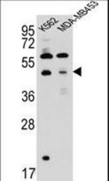 SNX29 Antibody western blot of K562,MDA-MB453 cell line lysates (35 ug/lane). The SNX29 antibody detected the SNX29 protein (arrow).