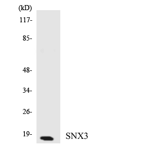 Western blot of the lysates from HUVEC cells using SNX3 antibody.