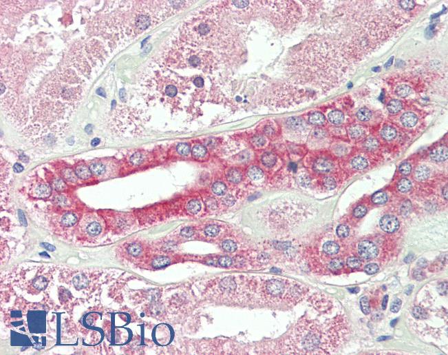 Anti-SNX3 antibody IHC staining of human kidney. Immunohistochemistry of formalin-fixed, paraffin-embedded tissue after heat-induced antigen retrieval. Antibody LS-B11355 concentration 20 ug/ml.