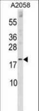 SNX3 Antibody western blot of A2058 cell line lysates (35 ug/lane). The SNX3 antibody detected the SNX3 protein (arrow).