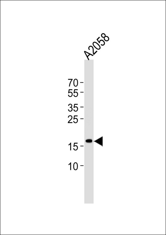 Western blot of lysate from A2058 cell line, using SNX3 Antibody. Antibody was diluted at 1:1000. A goat anti-rabbit IgG H&L (HRP) at 1:5000 dilution was used as the secondary antibody. Lysate at 35ug.
