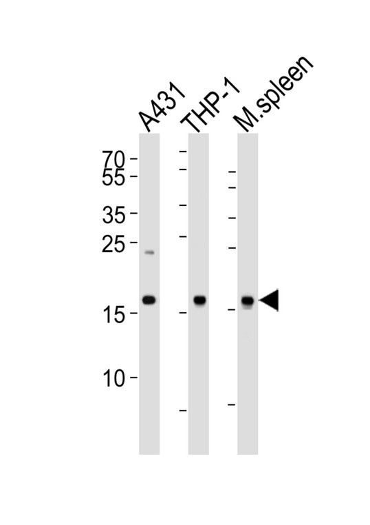Western blot of lysates from A431, THP-1 cell line and mouse spleen tissue lysate (from left to right), using SNX3 Antibody. Antibody was diluted at 1:1000 at each lane. A goat anti-rabbit IgG H&L (HRP) at 1:5000 dilution was used as the secondary antibody. Lysates at 35ug per lane.
